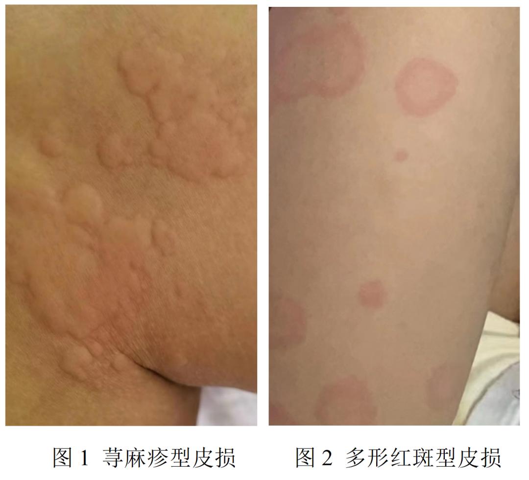 新冠病毒分離最新進(jìn)展，科研攻關(guān)的突破與希望之光